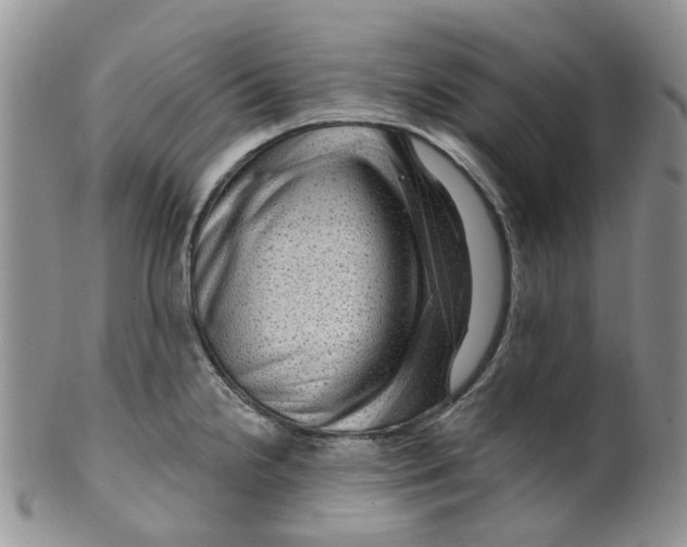 X0000099501238200806051115