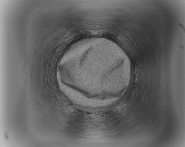 X0000099501249200806051114