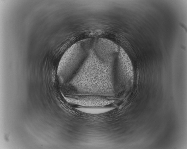 X0000099501250200806051114