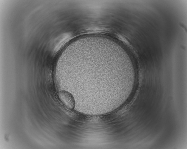 X0000099501259200806051114