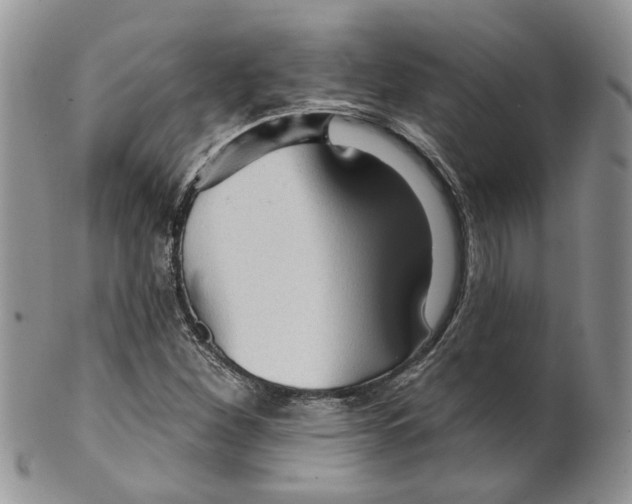 X0000099501260200806051114