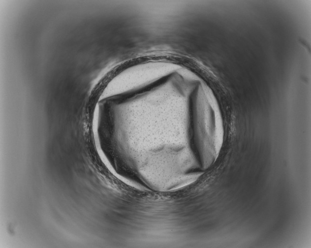 X0000099501400200806051111