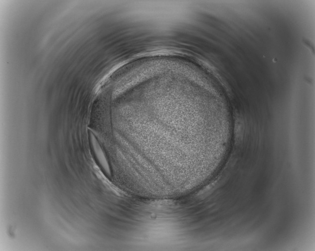 X0000099501417200806051111