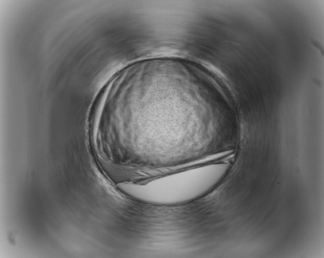 X0000099501423200806051111