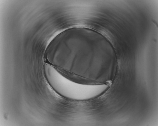 X0000099501428200806051111