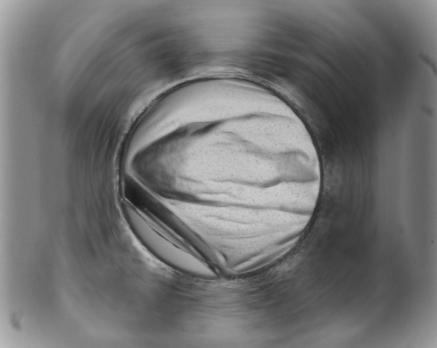 X0000099501430200806051111