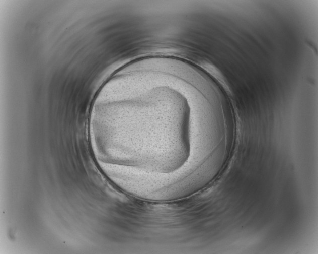 X0000099501436200806051111