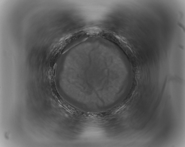 X0000099501445200806051111