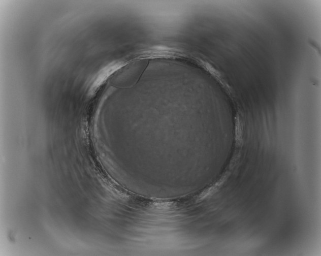 X0000099501453200806051111