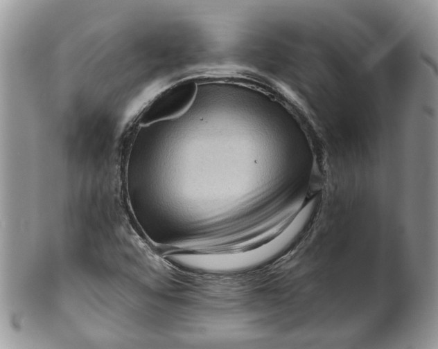 X0000099501456200806051111