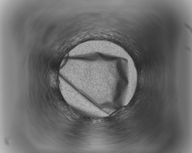 X0000099501490200806051109