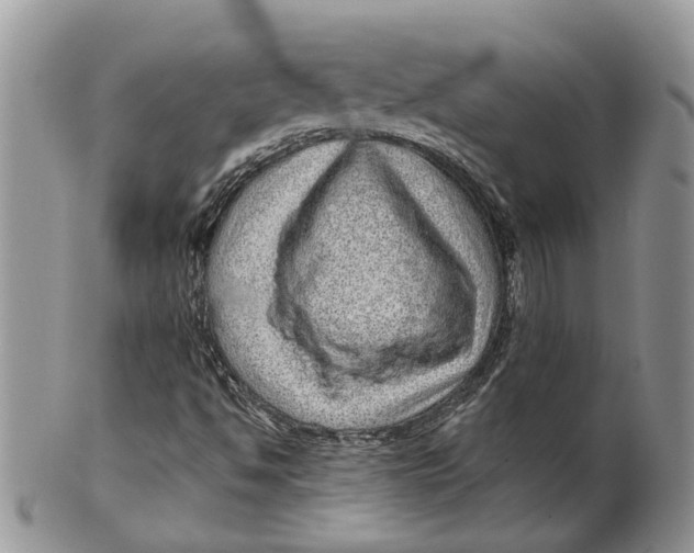 X0000099501494200806051110