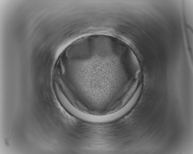 X0000099501520200806051110