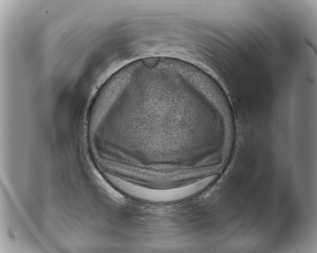 X0000099501525200806051110