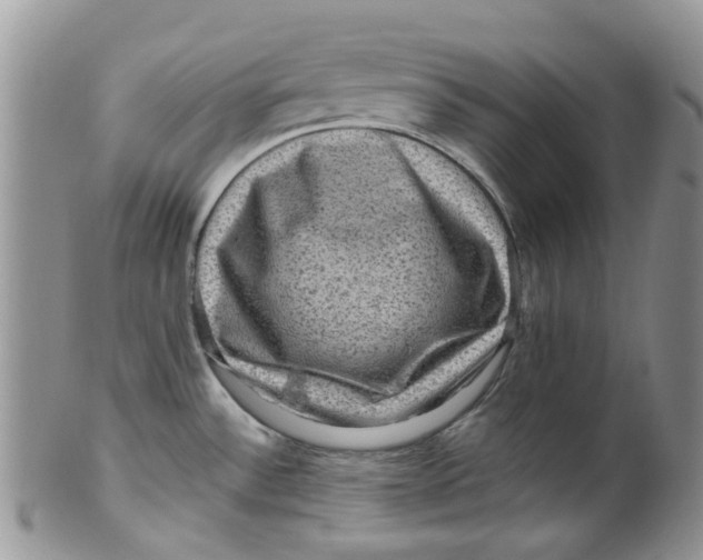 X0000099501532200806051110