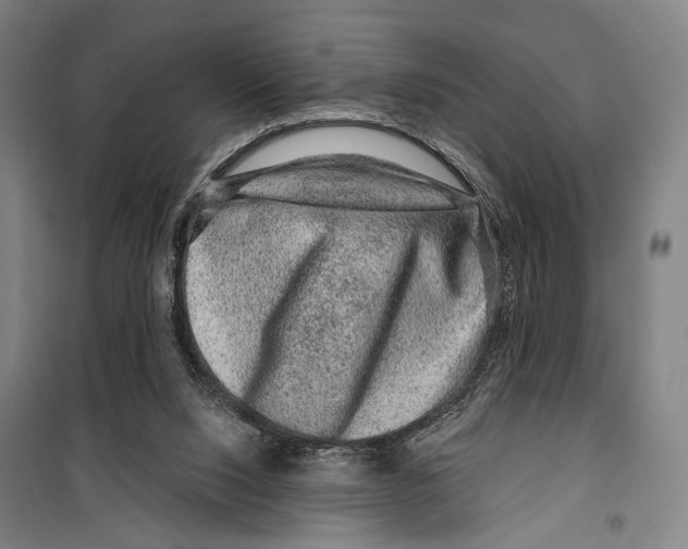 X0000099500064200806121425