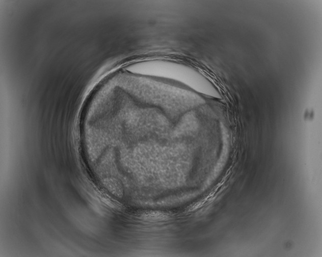 X0000099500198200806121423