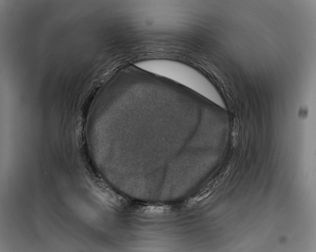 X0000099500314200806121421