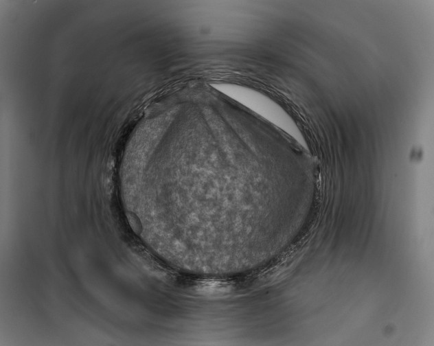 X0000099500319200806121421