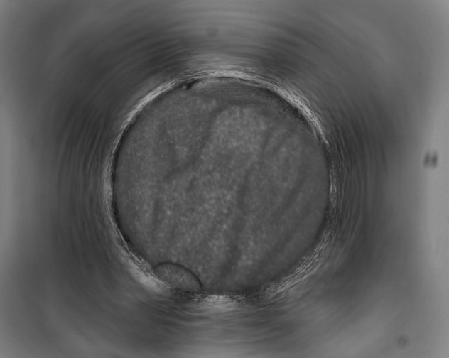 X0000099500390200806121420