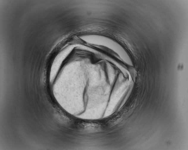 X0000099500400200806121420