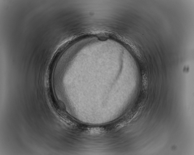 X0000099500587200806121417