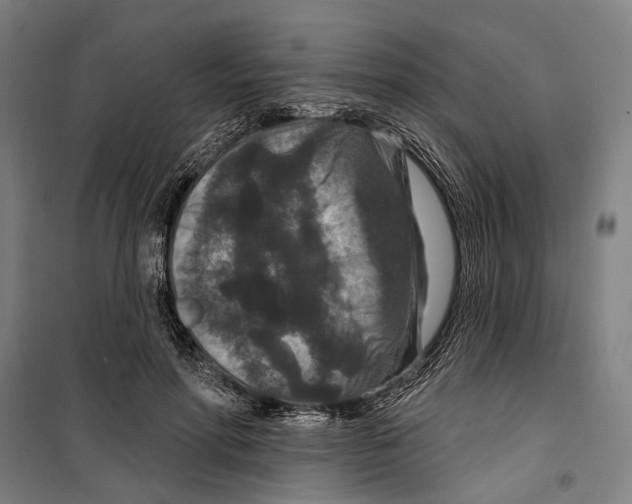 X0000099500598200806121417