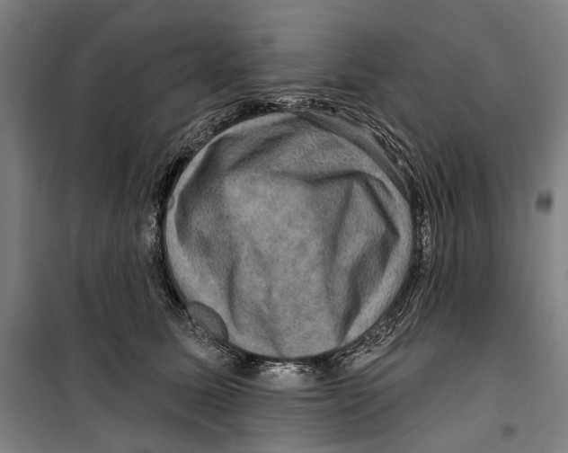 X0000099500611200806121417