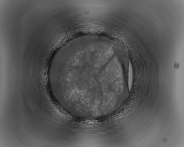 X0000099500642200806121416