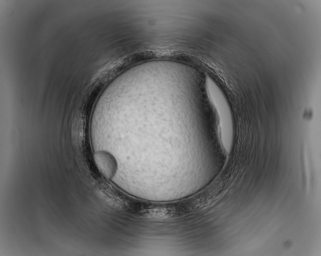 X0000099500740200806121415