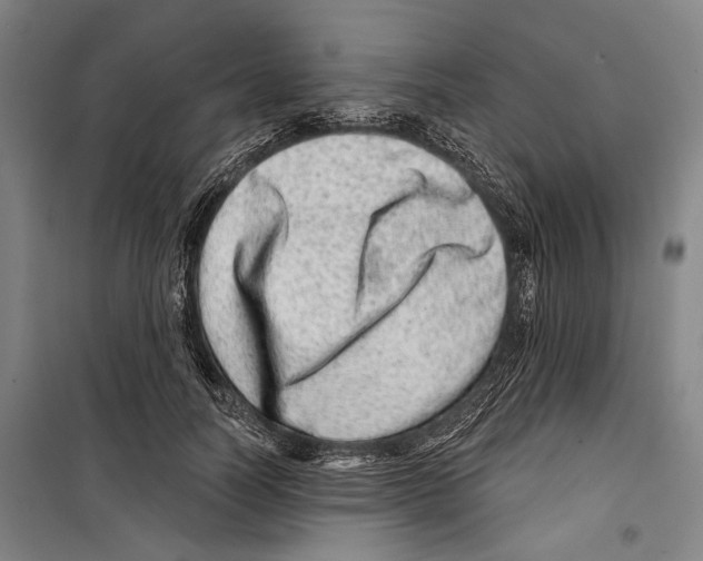 X0000099500746200806121415