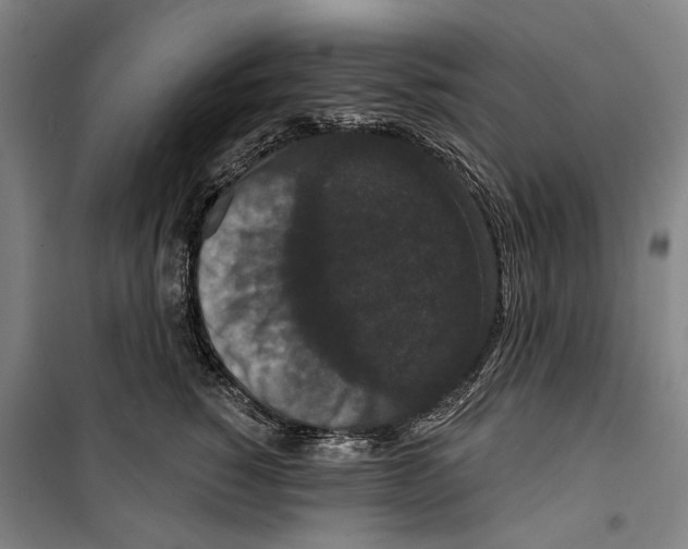 X0000099500760200806121415