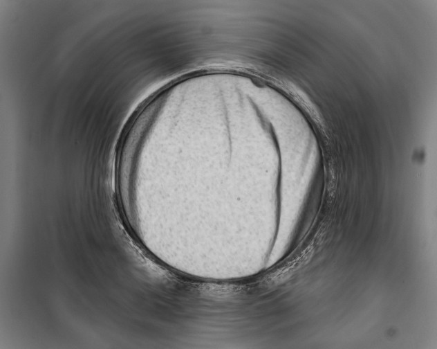 X0000099501036200806121411