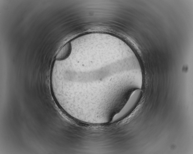 X0000099501041200806121411