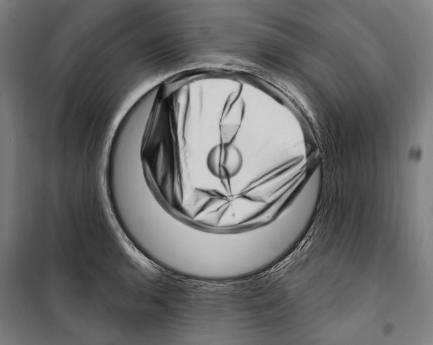 X0000099501136200806121409