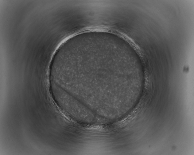 X0000099501174200806121408