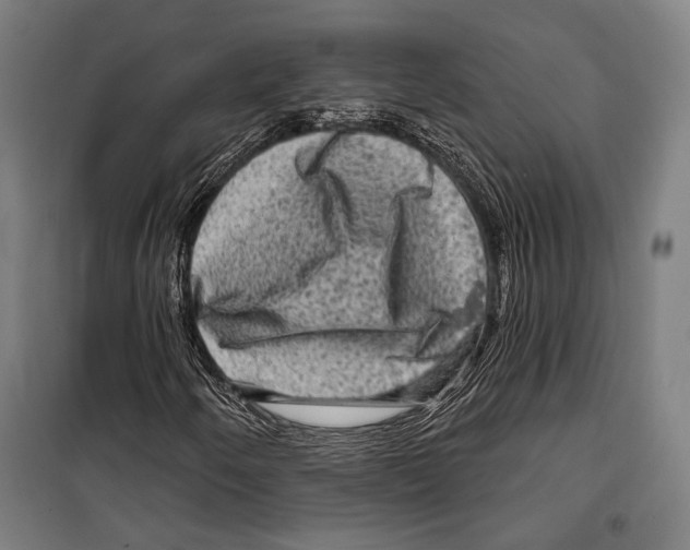 X0000099501250200806121407