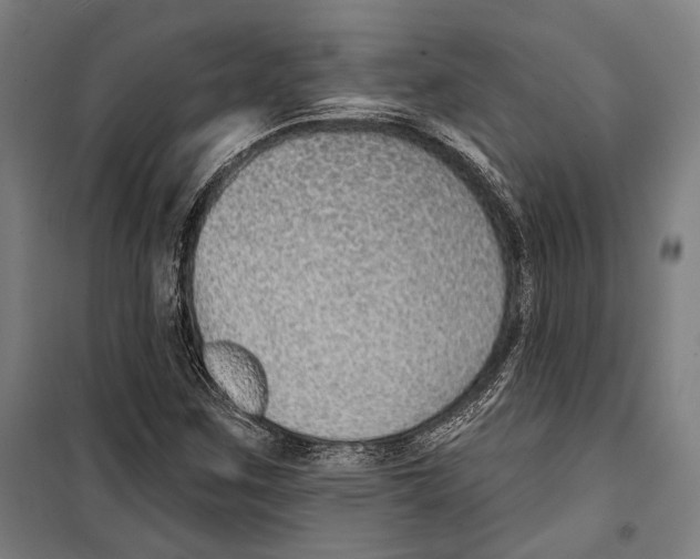 X0000099501259200806121407