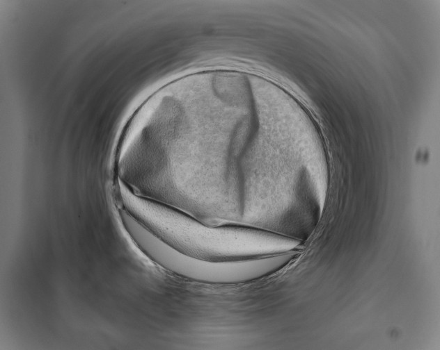 X0000099501536200806121404