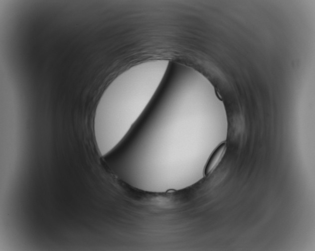 X0000099510236200805151017