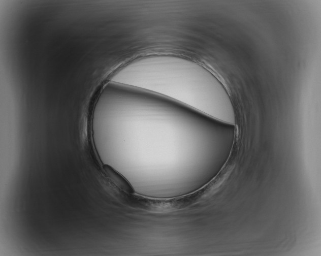 X0000099510301200805151017