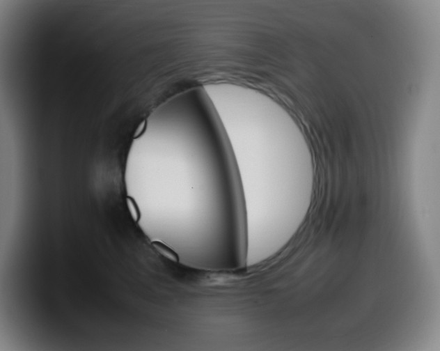 X0000099510617200805151012