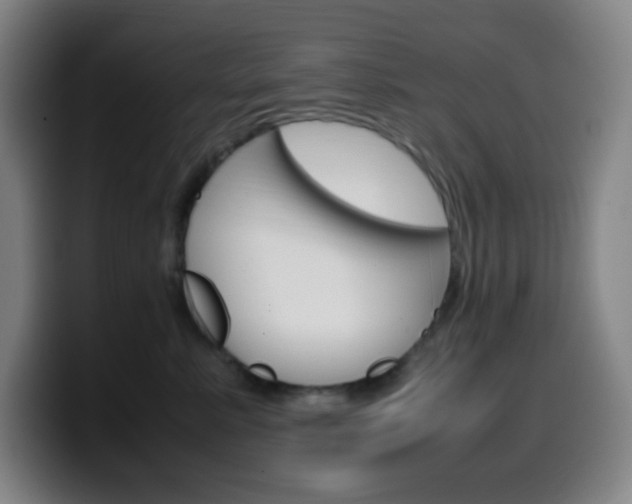X0000099510619200805151012
