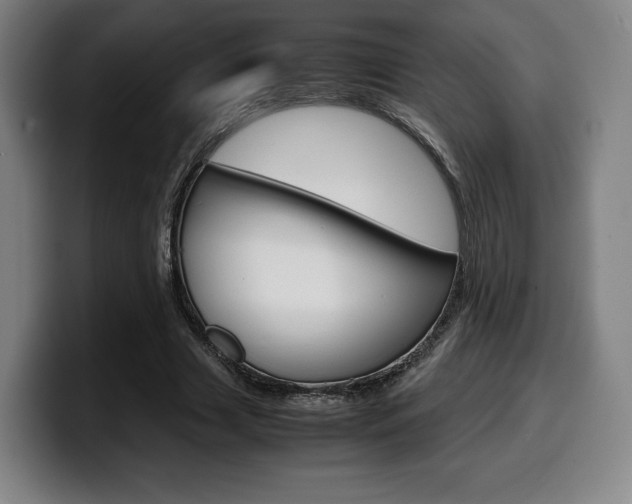 X0000099510633200805151011