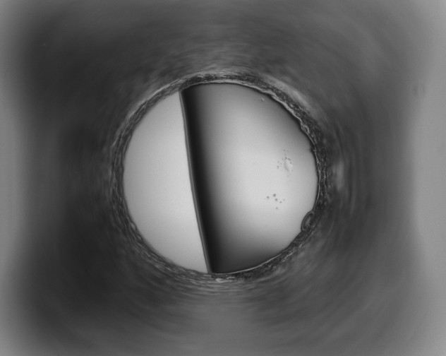 X0000099511160200805151004