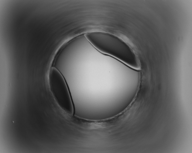 X0000099511181200805151004