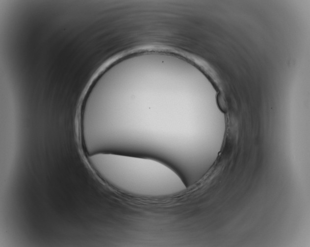 X0000099511295200805151003