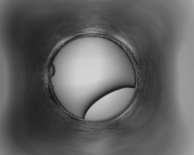 X0000099511358200805151002