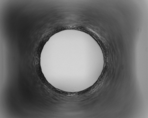 X0000099511447200805151000
