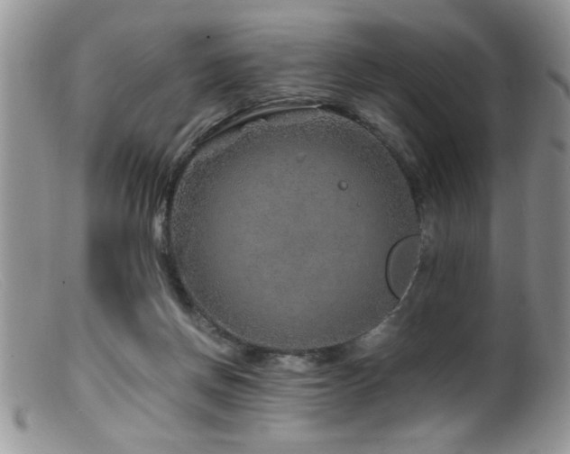 X0000099510166200805151508